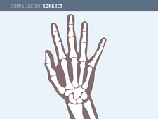 Röntgendiagnostik – Nutzen und Risiken (Reihe "Strahlenschutz Konkret") Röntgendiagnostik – Nutzen und Risiken (Reihe "Strahlenschutz Konkret")