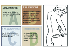 Die A-B-C-D-Regel bei der Selbstuntersuchung auf Hautkrebs Die A-B-C-D-Regel bei der Selbstuntersuchung auf Hautkrebs