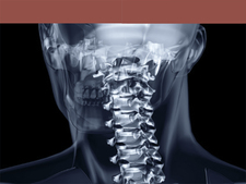 Röntgen: Nutzen und Risiko (mit Röntgenpass) Röntgen: Nutzen und Risiko (mit Röntgenpass)