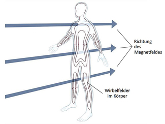 Wirkung magnetischer Wechselfelder auf den Menschen Wirkung magnetischer Wechselfelder auf den Menschen